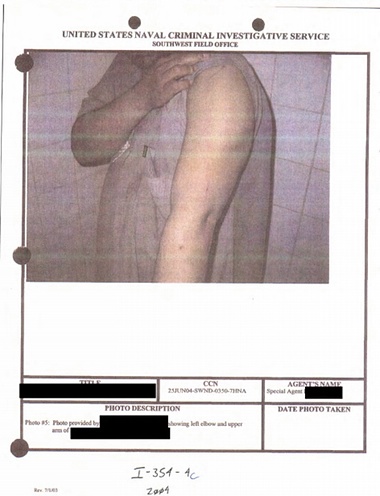Image depicts detainee’s arm injury. No further context was provided. Photograph: Department of Defense