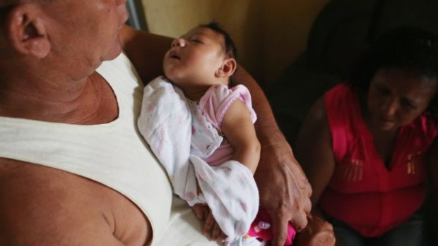 The virus is linked to thousands of cases of microcephaly in Brazil