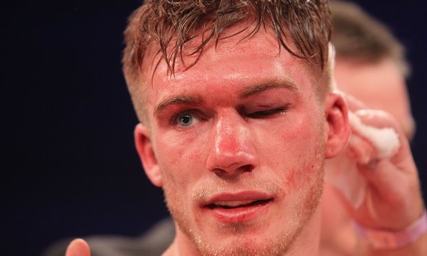 Nick Blackwell’s title bout against Chris Eubank Jr was stopped in the 10th round due to swelling above his eye. Photograph: TGSPhoto/Rex/Shutterstock